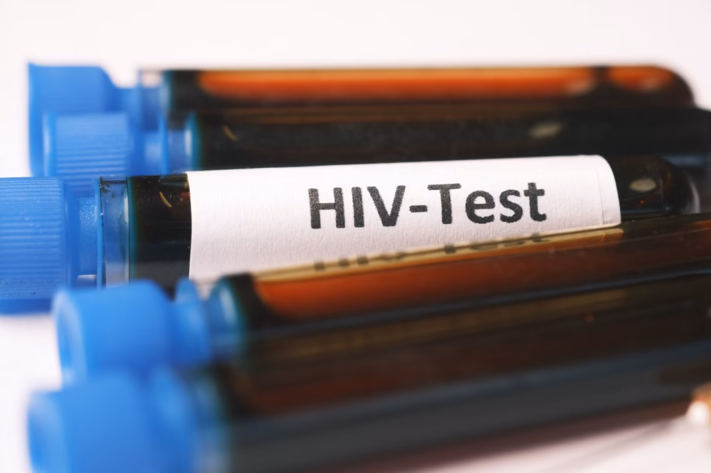 Fiji HIV vakalarındaki sert artış nedeniyle ulusal kriz ilan etti.